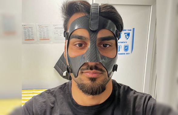Ștefan „Zorro” Baiaram » Fotbalistul Universității Craiova a primit verdictul: cât va fi nevoit să joace cu mască