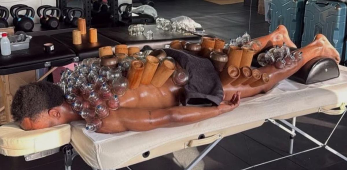 Atacantul lui Juventus, belgianul Louis Openda, terapie neconvențională cu ventuze