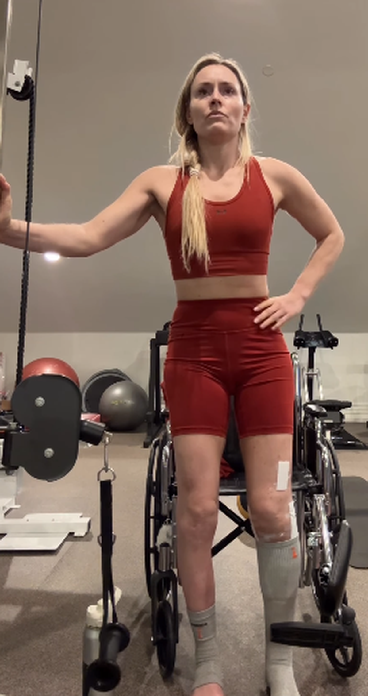 Lindsey Vonn a început recuperarea la picior