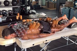 Imagine șocantă cu vârful de 44 de milioane! » Și-a acoperit tot corpul de ventuze