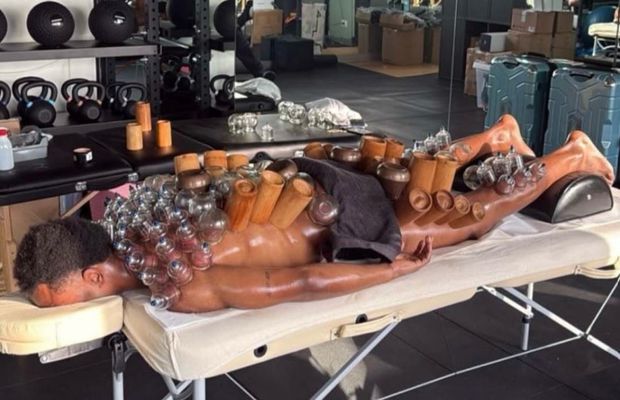 Imagine șocantă cu vârful de 44 de milioane! » Și-a acoperit tot corpul de ventuze