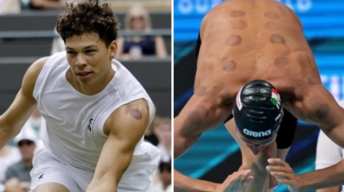 Atacantul lui Juventus, belgianul Louis Openda, terapie neconvențională cu ventuze