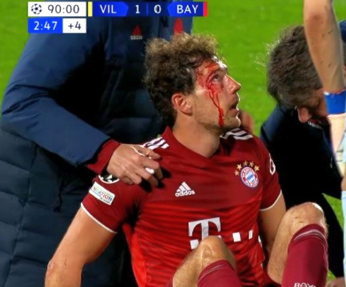 Fază controversată în Villarreal - Bayern! Goretzka, plin de sânge în prelungiri