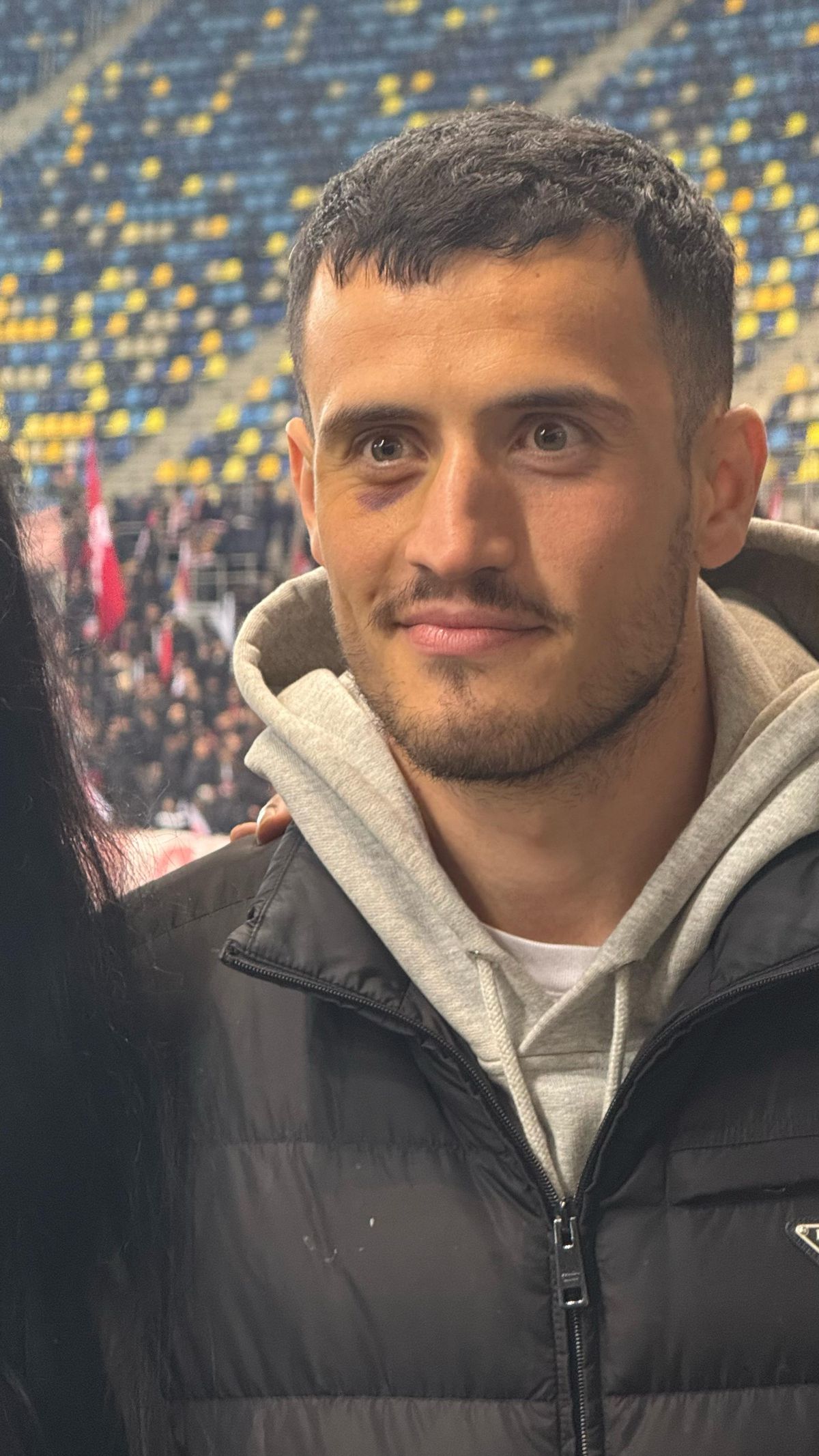 Încă se văd urmele loviturii lui Crețu! Cum a apărut Astrit Selmani la Rapid - Dinamo