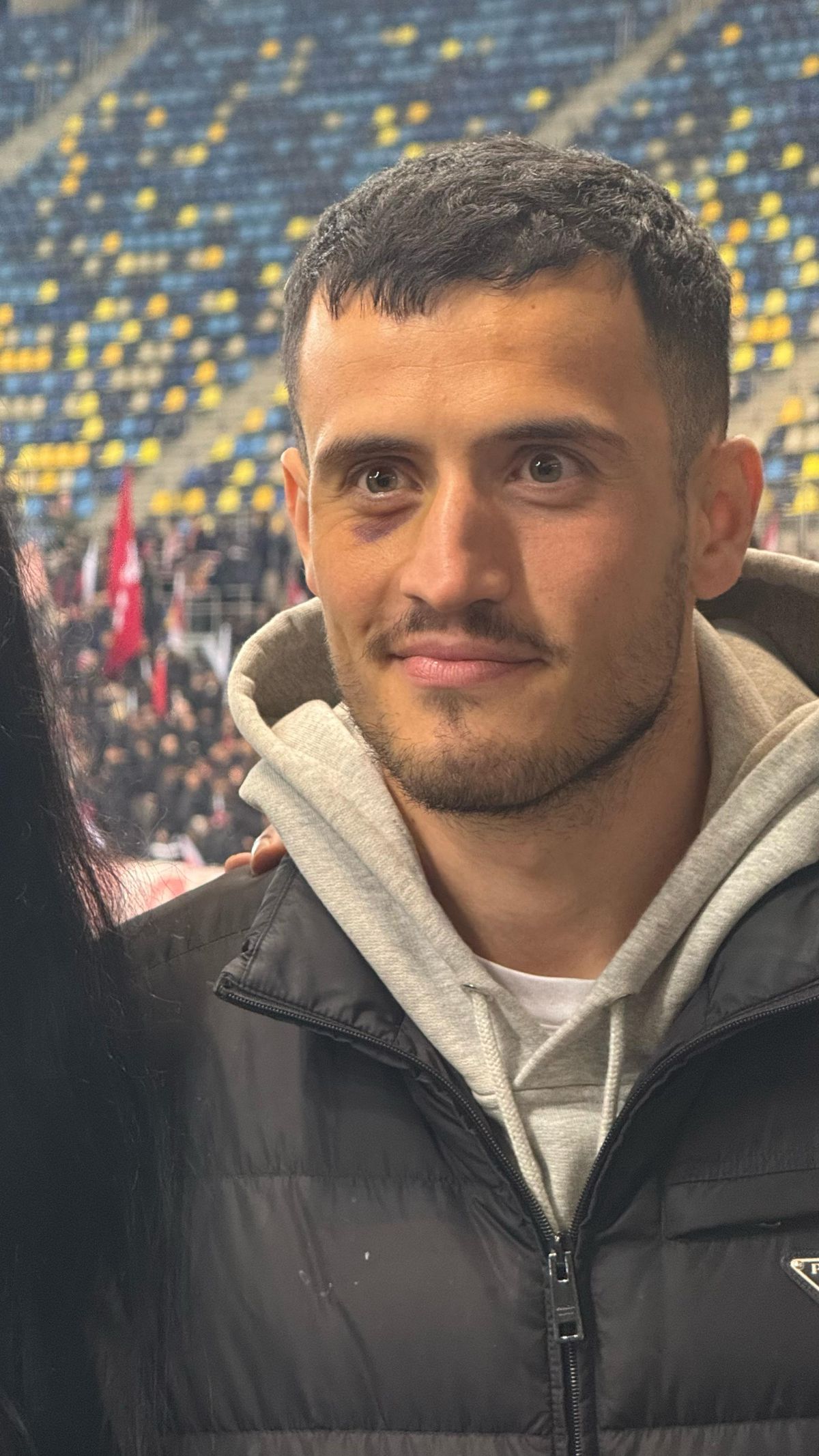 Încă se văd urmele loviturii lui Crețu! Cum a apărut Astrit Selmani la Rapid - Dinamo