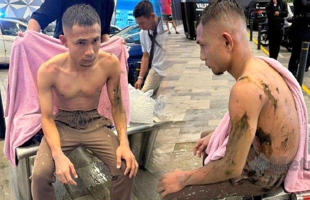 Fotbalist rănit într-un atac cu acid la un centru comercial