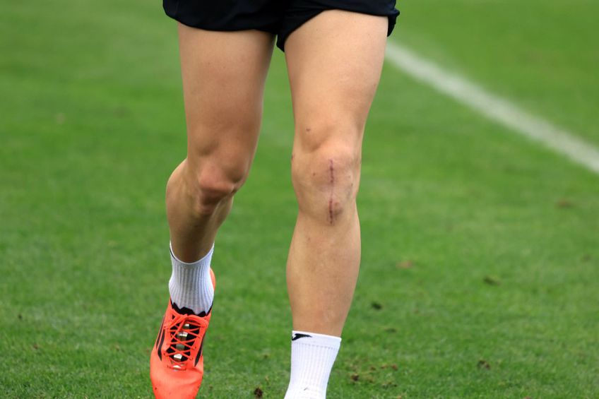 CORESPONDENȚĂ GSP DIN ANTALYA Revenire miraculoasă la antrenamentele lui FCSB! Cum arată genunchiul lui Mihai Popescu, după accidentarea gravă și operație