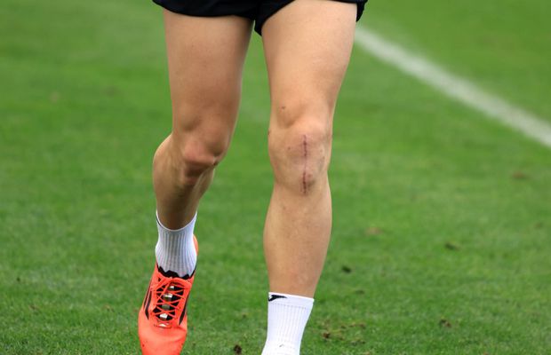 Revenire miraculoasă la antrenamentele lui FCSB! Cum arată genunchiul lui Mihai Popescu, după accidentarea gravă și operație