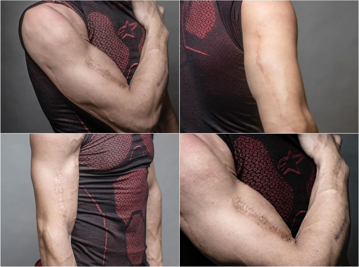 Durere și artă » Piloții din MotoGP așa cum nu i-ai mai văzut » S-au dezbrăcat și își arată cicatricile șocante, dar și tatuajele spectaculoase