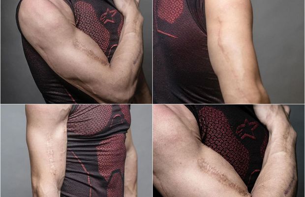 Durere și artă » Piloții din MotoGP așa cum nu i-ai mai văzut » S-au dezbrăcat și își arată cicatricile șocante, dar și tatuajele spectaculoase