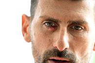 Ochiul lui Novak Djokovic nu arată bine! A fost fotografiat de aproape, iar imaginea îi îngrijorează pe fanii sârbului