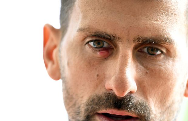 Ochiul lui Novak Djokovic nu arată bine! A fost fotografiat de aproape, iar imaginea îi îngrijorează pe fanii sârbului