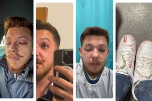 Oficiali de la Sepsi, acuzați de agresiune! Scandalul, provocat de politică și alegerile din Ungaria: „Un tânăr poate fi bătut până la sânge doar pentru că gândește diferit” » Dioszegi amenință cu măsuri!