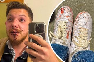 Scandal imens la Sfântu Gheorghe: „secundul” lui Sepsi, acuzat că l-a luat la pumni! » De la ce a pornit totul + Dioszegi amenință cu măsuri