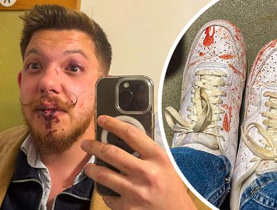 Scandal imens la Sfântu Gheorghe: „secundul” lui Sepsi, acuzat că l-a luat la pumni! » De la ce a pornit totul + Dioszegi amenință cu măsuri