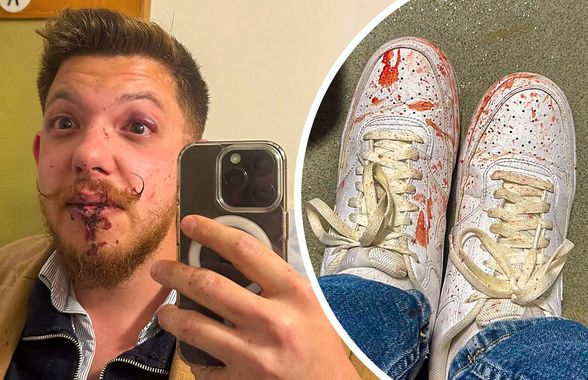 Scandal imens la Sfântu Gheorghe: „secundul” lui Sepsi, acuzat că l-a luat la pumni! » De la ce a pornit totul + Dioszegi amenință cu măsuri