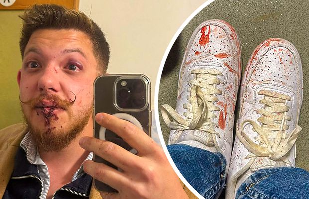 Scandal imens la Sfântu Gheorghe: „secundul” lui Sepsi, acuzat că l-a luat la pumni! » De la ce a pornit totul + Dioszegi amenință cu măsuri