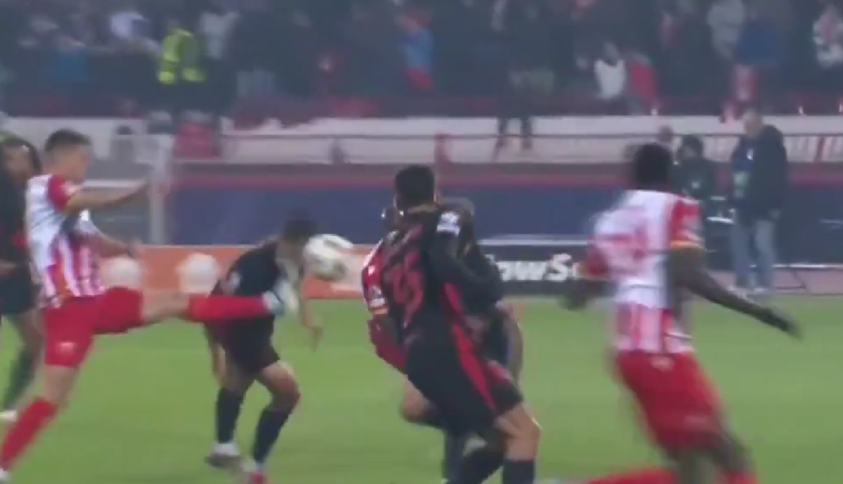 Greu de privit! Imagini HORROR cu fotbalistul Barcelonei » Cum arată după ce a fost șters cu crampoanele pe față în Liga Campionilor