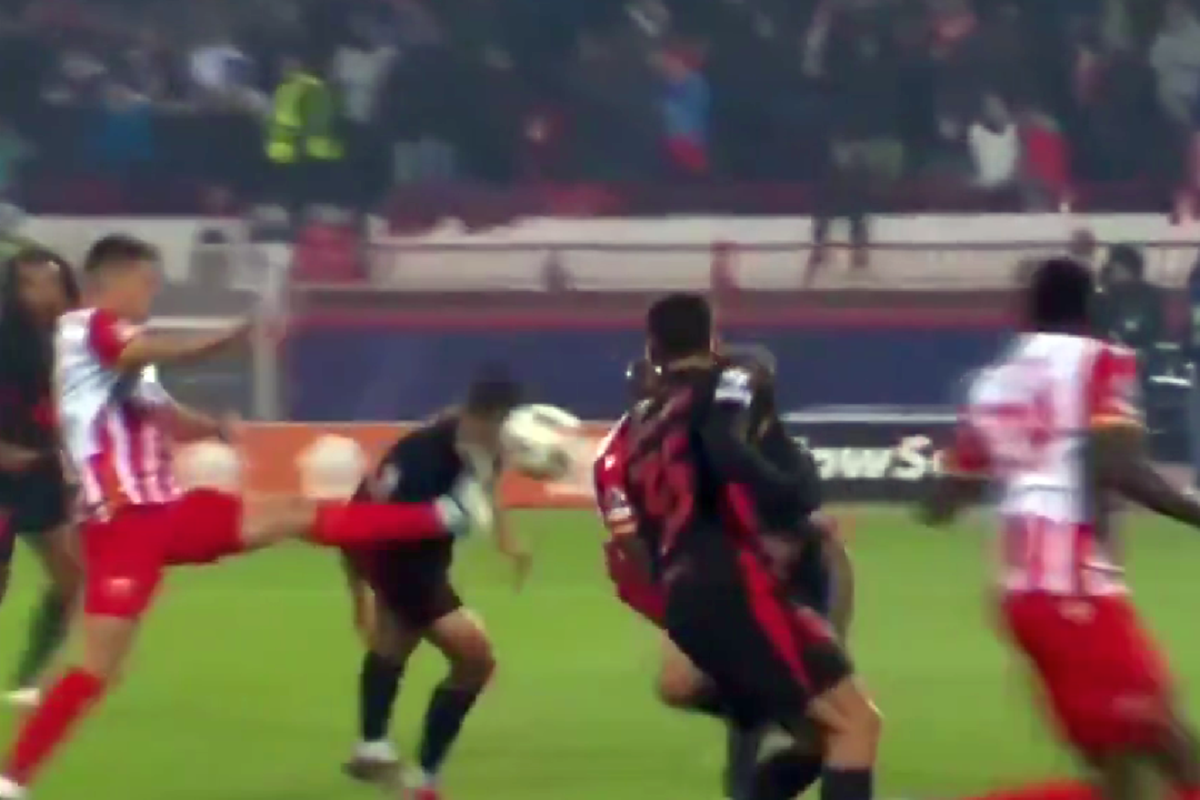 Greu de privit! Imagini HORROR cu fotbalistul Barcelonei » Cum arată după ce a fost șters cu crampoanele pe față în Liga Campionilor