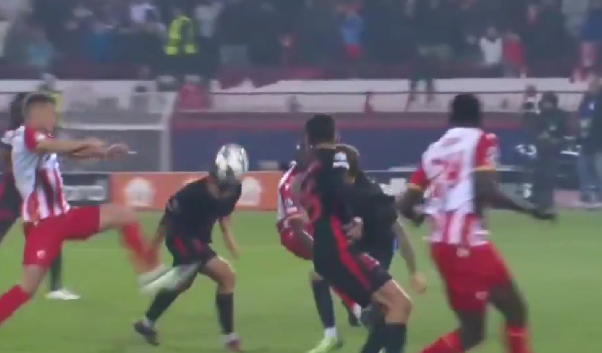 Greu de privit! Imagini HORROR cu fotbalistul Barcelonei » Cum arată după ce a fost șters cu crampoanele pe față în Liga Campionilor