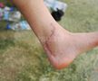 Imagini brutale surprinse de GSP în Antalya! Cum arată acum piciorul lui Dragoș Iancu, la aproape 4 luni de la teribila accidentare