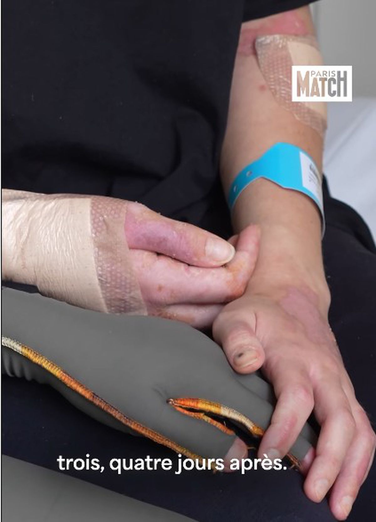 Tahirys Dos Santos își povește drama trăită în incendiul de Anul Nou la Crans Montana