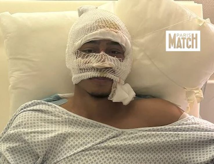 Imagini cu Tahirys Dos Santos din spitalul din Stuttgart, unde a suferit mai multe transplanturi de piele / Foto: X Instagram parismatch