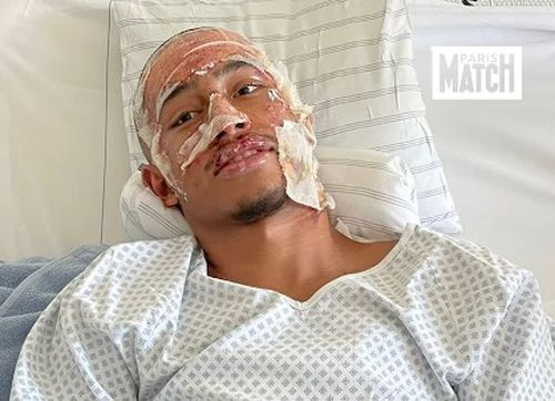 Imagine cu Tahirys Dos Santos din spitalul din Stuttgart, unde a suferit mai multe transplanturi de piele / Foto: X Instagram parismatch