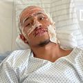 Imagine cu Tahirys Dos Santos din spitalul din Stuttgart, unde a suferit mai multe transplanturi de piele / Foto: X Instagram parismatch