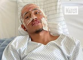 Mărturia teribilă a fotbalistului supraviețuitor al tragediei din Crans Montana: „Peste tot erau trupuri arse... ca în scenele de război. Am crezut că voi muri!”