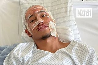 Mărturia teribilă a fotbalistului supraviețuitor al tragediei din Crans Montana: „Peste tot erau trupuri arse... ca în scenele de război. Am crezut că voi muri!”