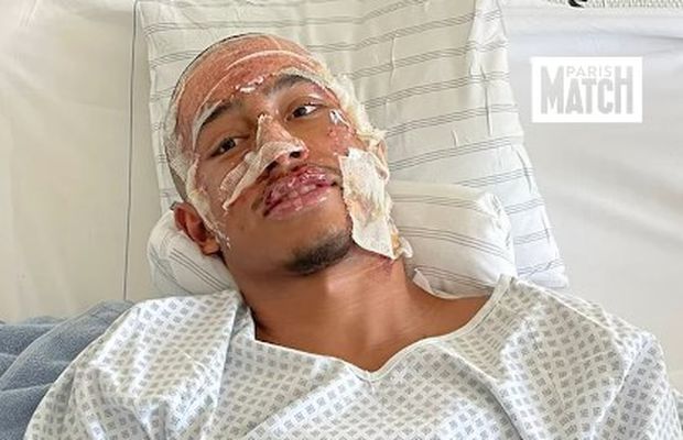 Mărturia teribilă a fotbalistului supraviețuitor al tragediei din Crans Montana: „Peste tot erau trupuri arse... ca în scenele de război. Am crezut că voi muri!”