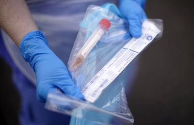 Primul deces în România al unui cadru medical din cauza coronavirusului