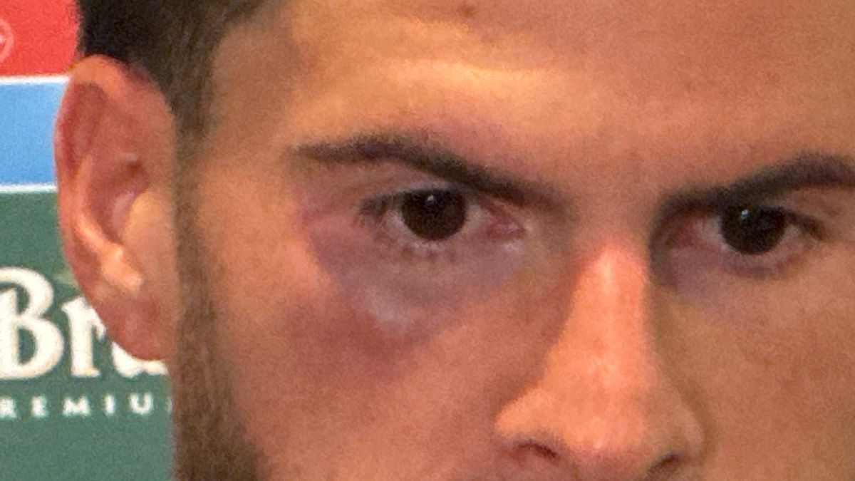 Cum a apărut Tudor Băluță, după Craiova - Trnava