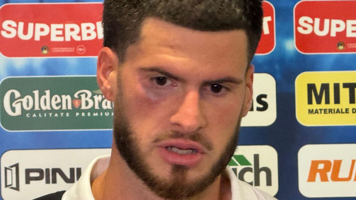 Șocant! » Cum arată Tudor Băluță, după cotul primit în figură la Craiova - Trnava: „Doar ce scăpasem de durere”