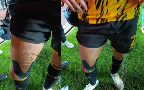 Juan Godoy arată urmele lăsate pe coapsă de racheta care l-a lovit în meciul The Strongest - Blooming 3-2 din Bolivia / Foto: X