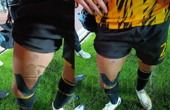 Eroul meciului, lovit de suporterii săi cu o rachetă! » Mijlocașul a părăsit terenul cu arsuri