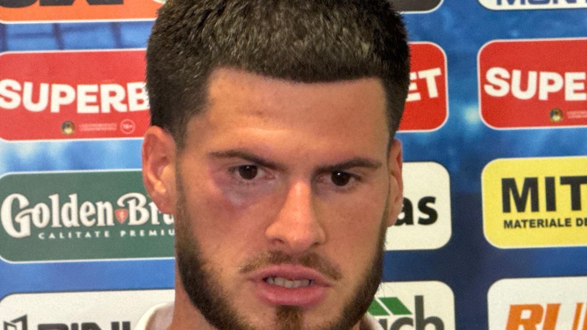 Șocant! » Cum arată Tudor Băluță, după cotul primit în figură la Craiova - Trnava: „Doar ce scăpasem de durere”