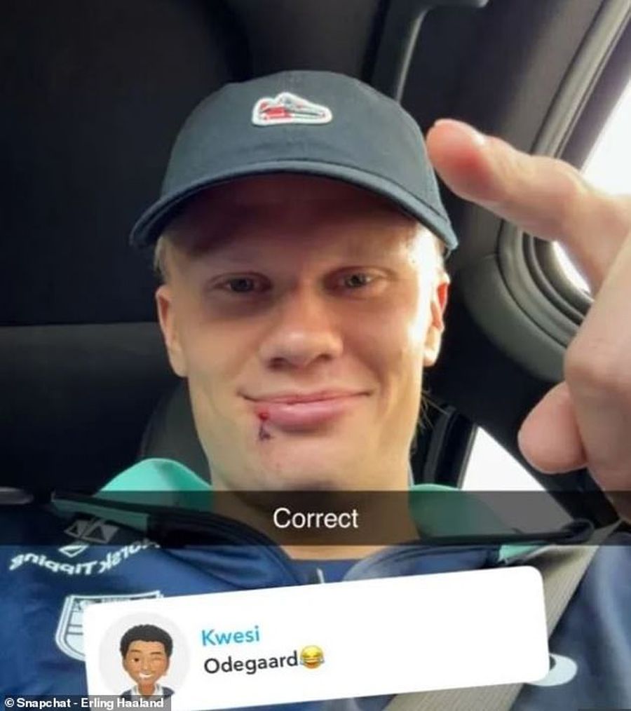 Haaland a apărut „șifonat” la față: „Cine te-a lovit?”