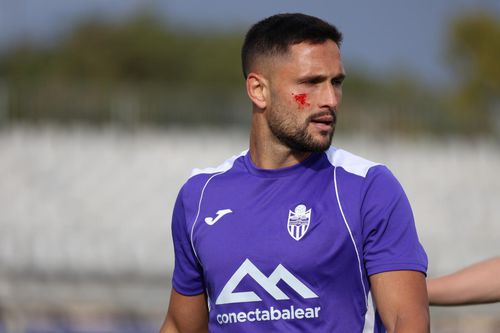 Florin Andone, rănit la față în primul meci ca titular // foto: X @ Atlético Baleares