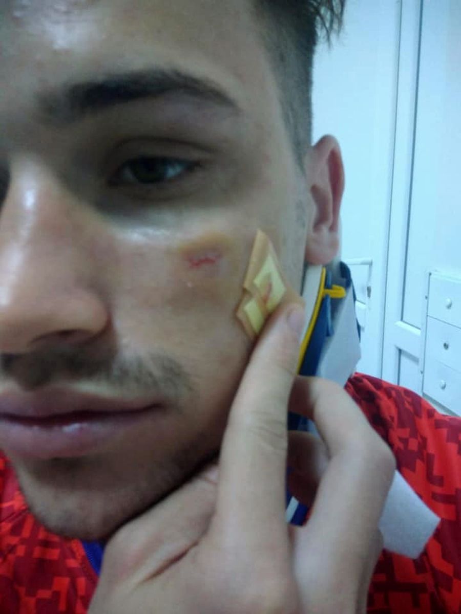 Așa arată Darius Olaru după meciul FCSB - Craiova
