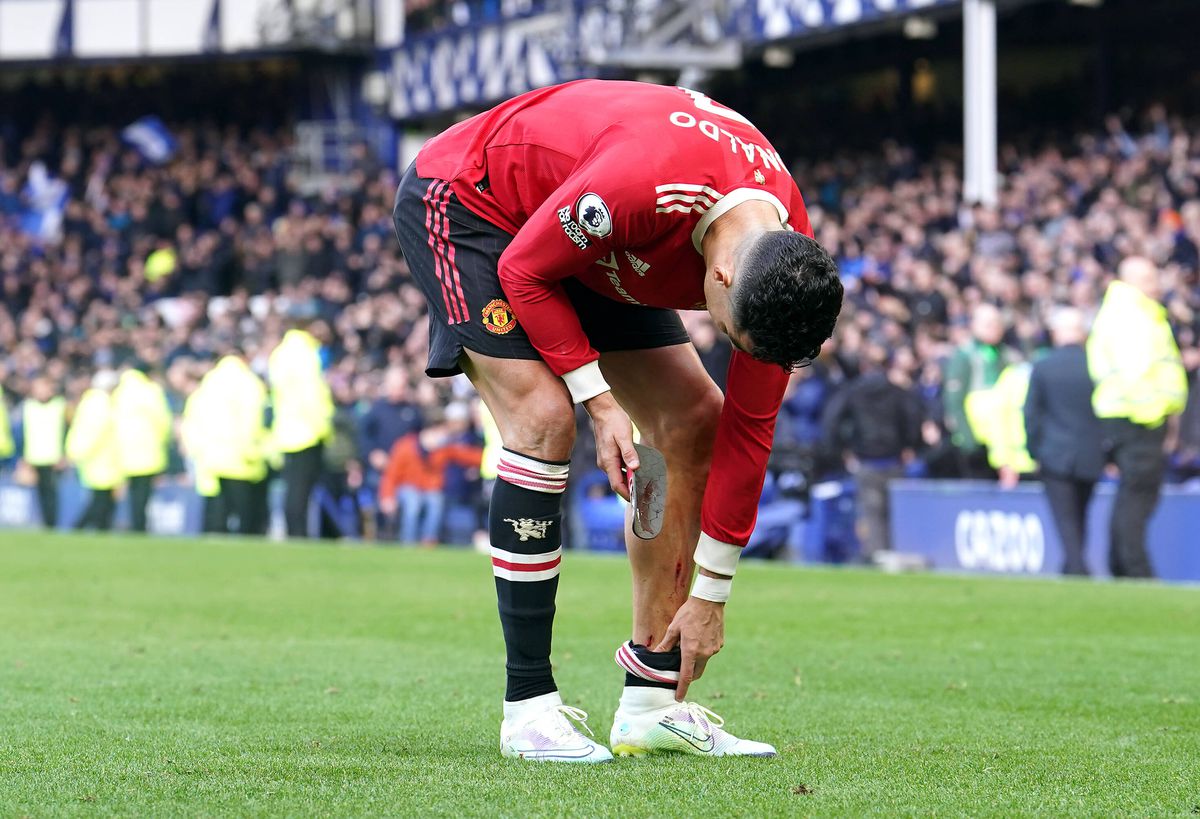 Cristiano Ronaldo, răni după Everton - Manchester United / FOTO: Imago