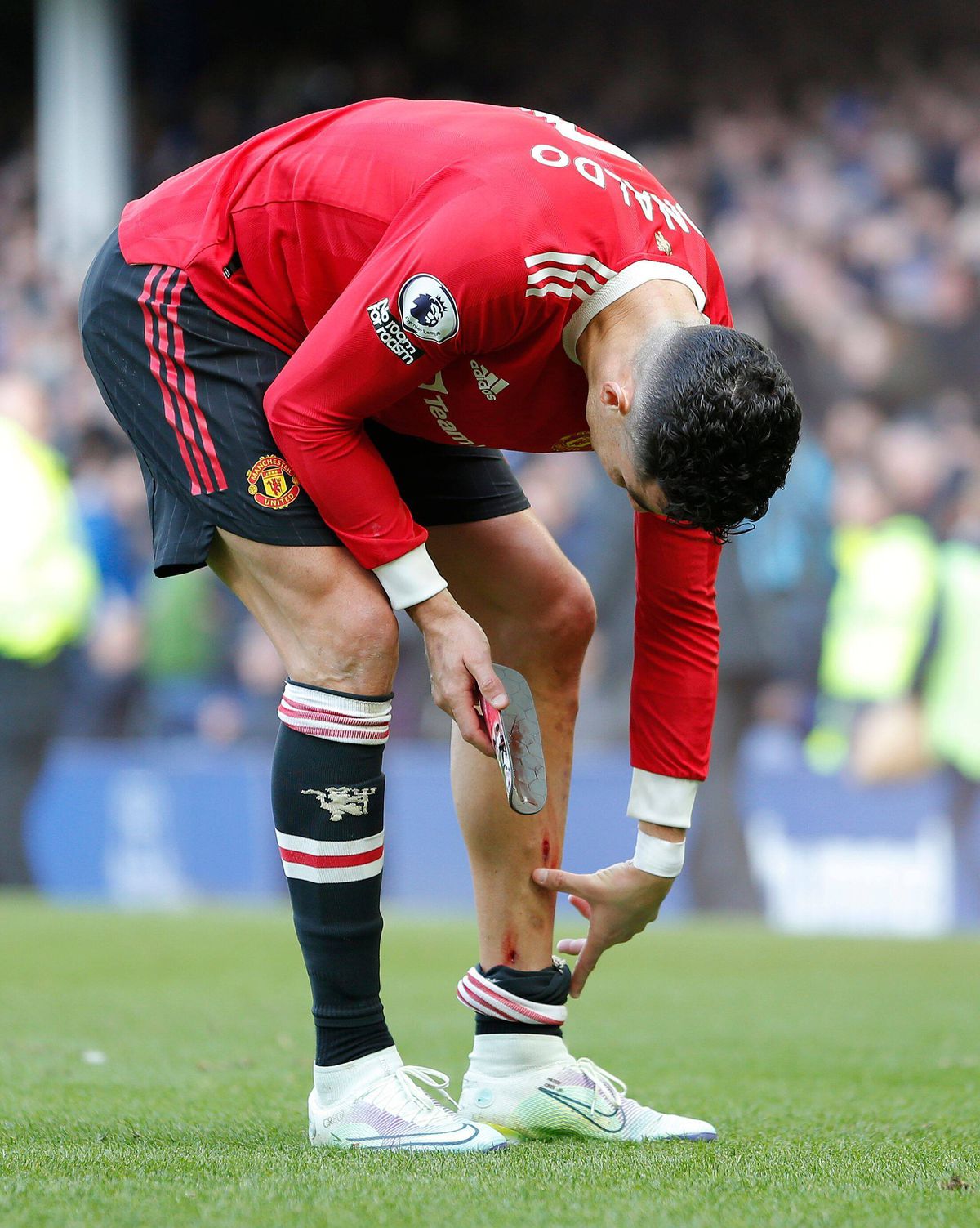 Cristiano Ronaldo, răni după Everton - Manchester United / FOTO: Imago