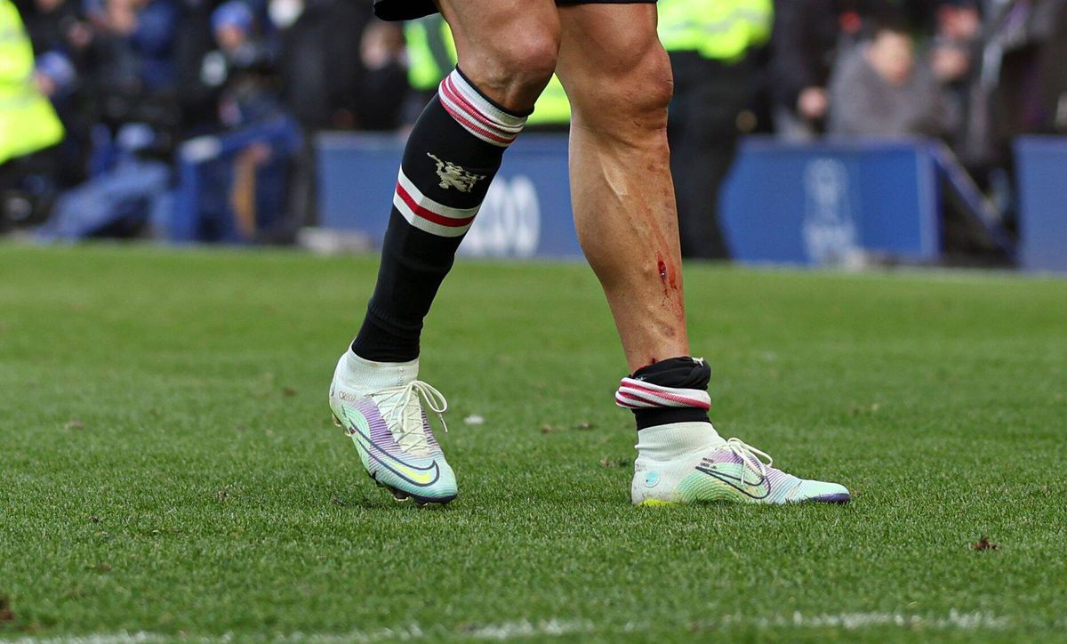 Cristiano Ronaldo, rănit și plin de nervi după 0-1 cu Everton: i-a spart telefonul unui suporter » De Gea: „O rușine, inacceptabil!”