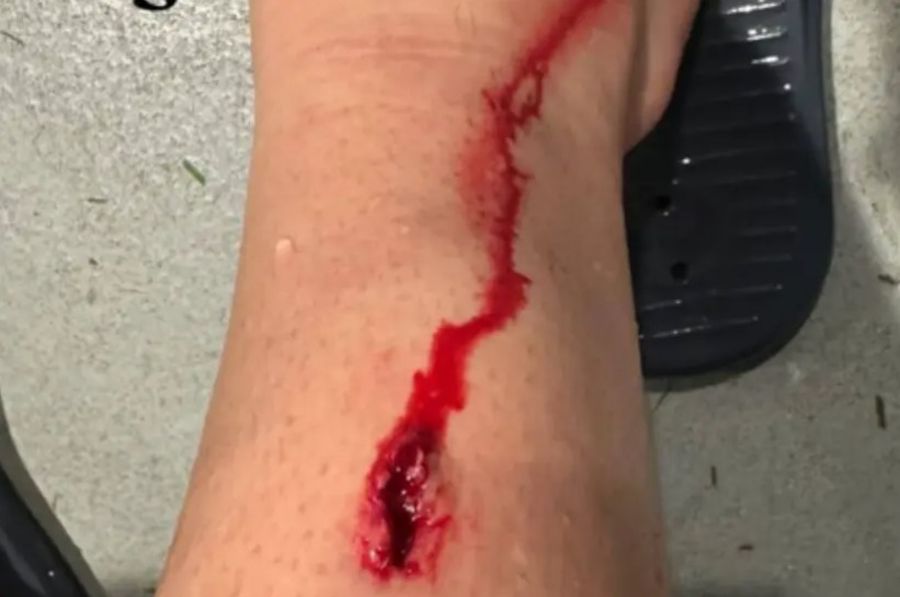 Atenție, imagini șocante! Jucătorul lui Bilbao acuză: „Fără cartonaș roșu, fără galben, fără fault, joacă...”