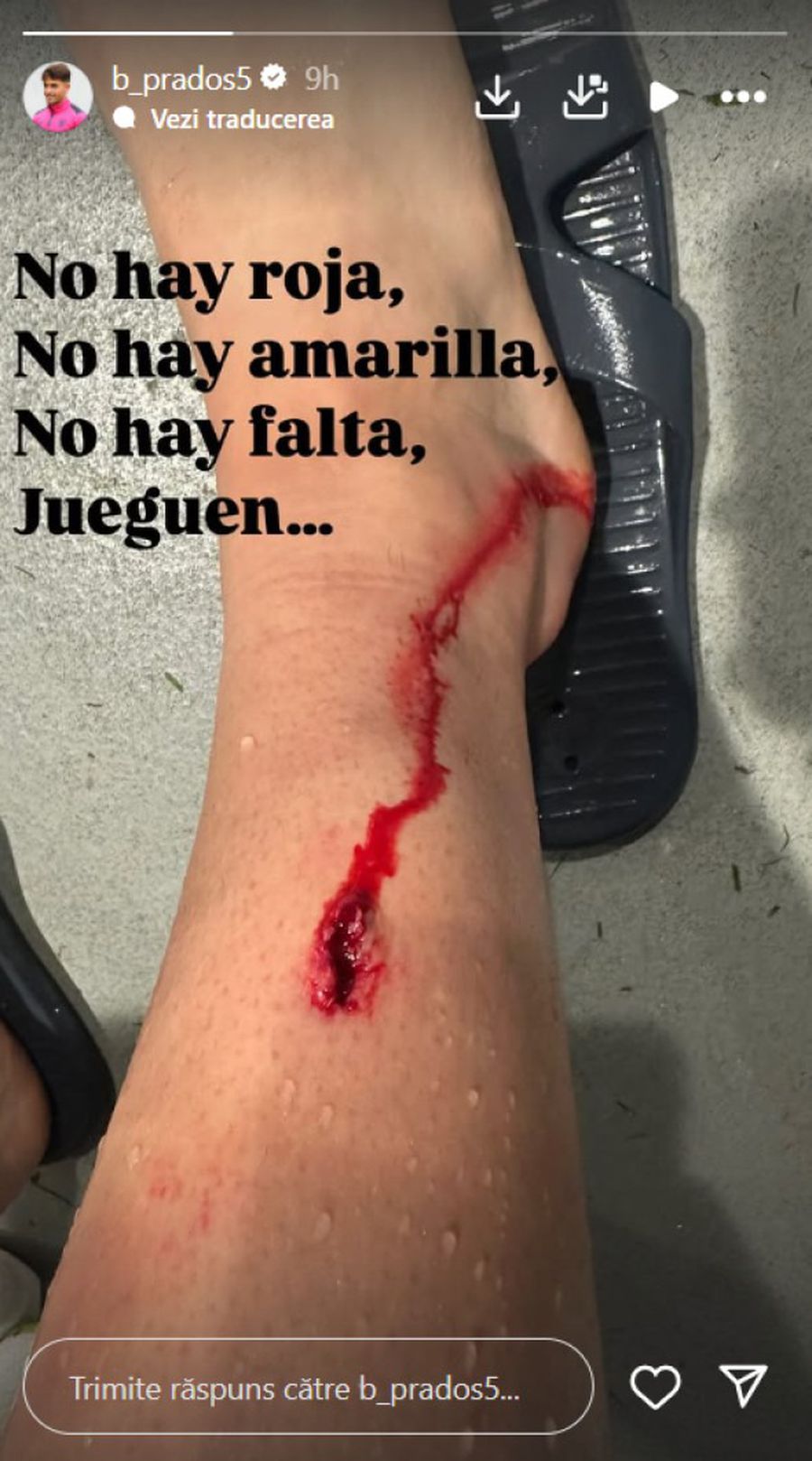 Atenție, imagini șocante! Jucătorul lui Bilbao acuză: „Fără cartonaș roșu, fără galben, fără fault, joacă...”