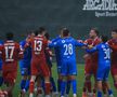Rezultat îngrijorător pentru Universitatea Craiova în Antalya: liderul din Superligă a fost subordonat de echipa secundă a clubului din Bundesliga
