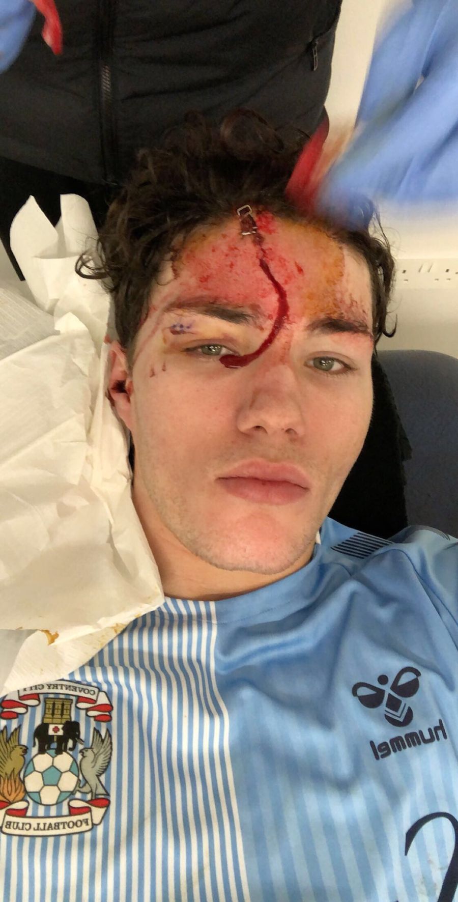 FOTO Callum O'Hare a jucat jumătate de oră cu o accidentare îngrozitoare, iar fanii lui Aston Villa îl vor înapoi! Atenție, imagini cu puternic impact emoțional