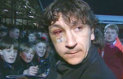 RETRO GSP. Un sfert de veac de la cea mai șocantă accidentare a unui fotbalist