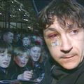 Așa arăta Ivano Bonetti, fratele mai mic al lui Dario, după ce a fost accidentat de farfuria cu pui